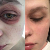 MIRACLETOX Angelto Feel Cream