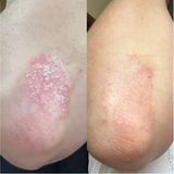 MIRACLETOX Angelto Feel Cream